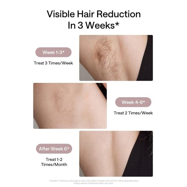 Ulike Laser Hair Removal for Women and Men, Air 3 Ice-Cooling IPL Device Hair Removal for Nearly Painless & Long-Lasting Results, 3 Modes & Auto Flashing for Fast Full Body Hair Removal from Home - Imagen 4