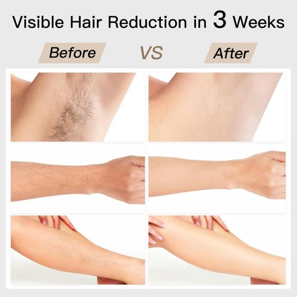 Laser Hair Removal, BoSidin IPL Hair Removal with Painless Ice-Cooling, 2-in-1 Face SR Rejuvenation, 6+1 Modes, 6 Levels Hair Removal for Women Permanent, Laser Hair Removal Kit with Shaver, Goggles - Image 3