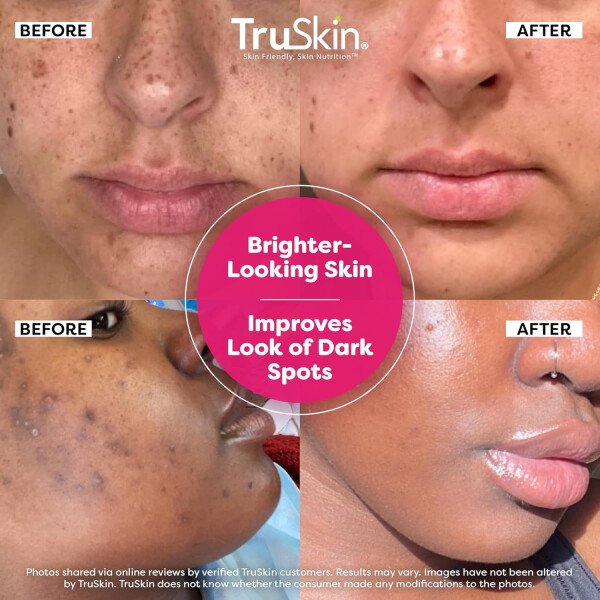TruSkin Vitamin C-Plus Super Serum - Suero facial antiarrugas antienvejecimiento con niacinamida, retinol, ácido hialurónico y ácido salicílico, 1 onza líquida - Imagen 2