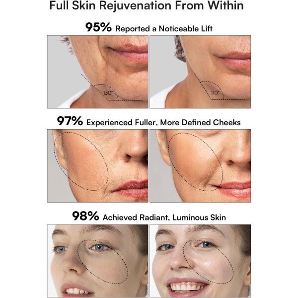 INIA Dispositivo facial de microcorriente, masajeador facial 3 en 1, terapia de luz roja para cara y cuello, dispositivo de brillo de verdadera belleza eficaz para arrugas e hinchazón - Imagen 5