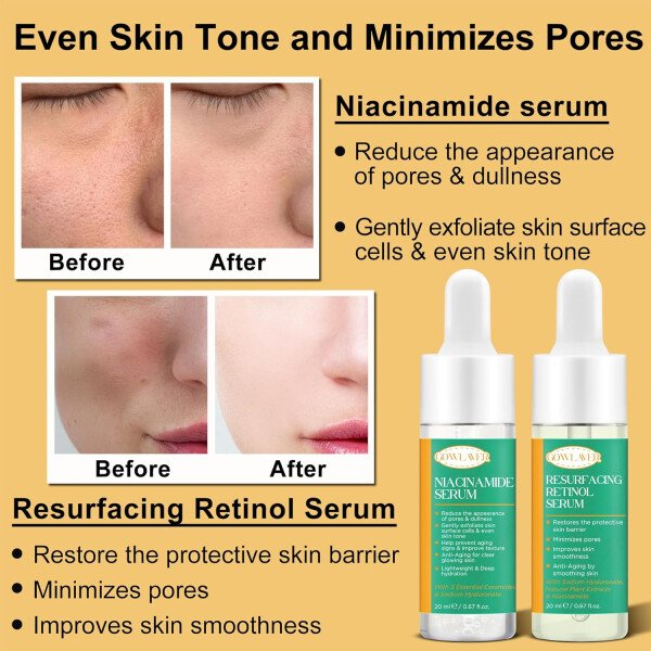 Kit de cuidado de la piel antienvejecimiento para mujeres y adolescentes, suero de retinol de niacinamida, suero de ácido hialurónico, juego de regalo para el cuidado de la piel, productos para el - Imagen 4